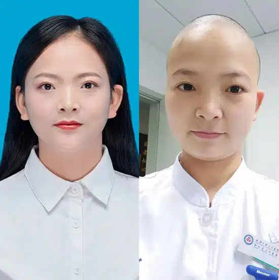 ฝันว่าโกนหัว